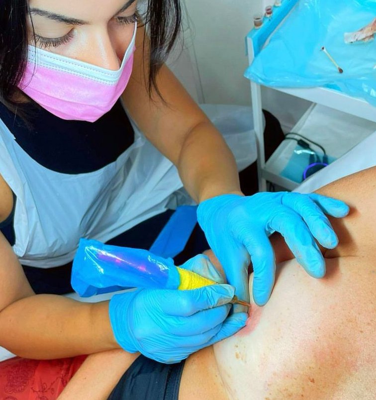 Skarlet Leon performing paramedical areola tattoo — Queens Park Bournemouth