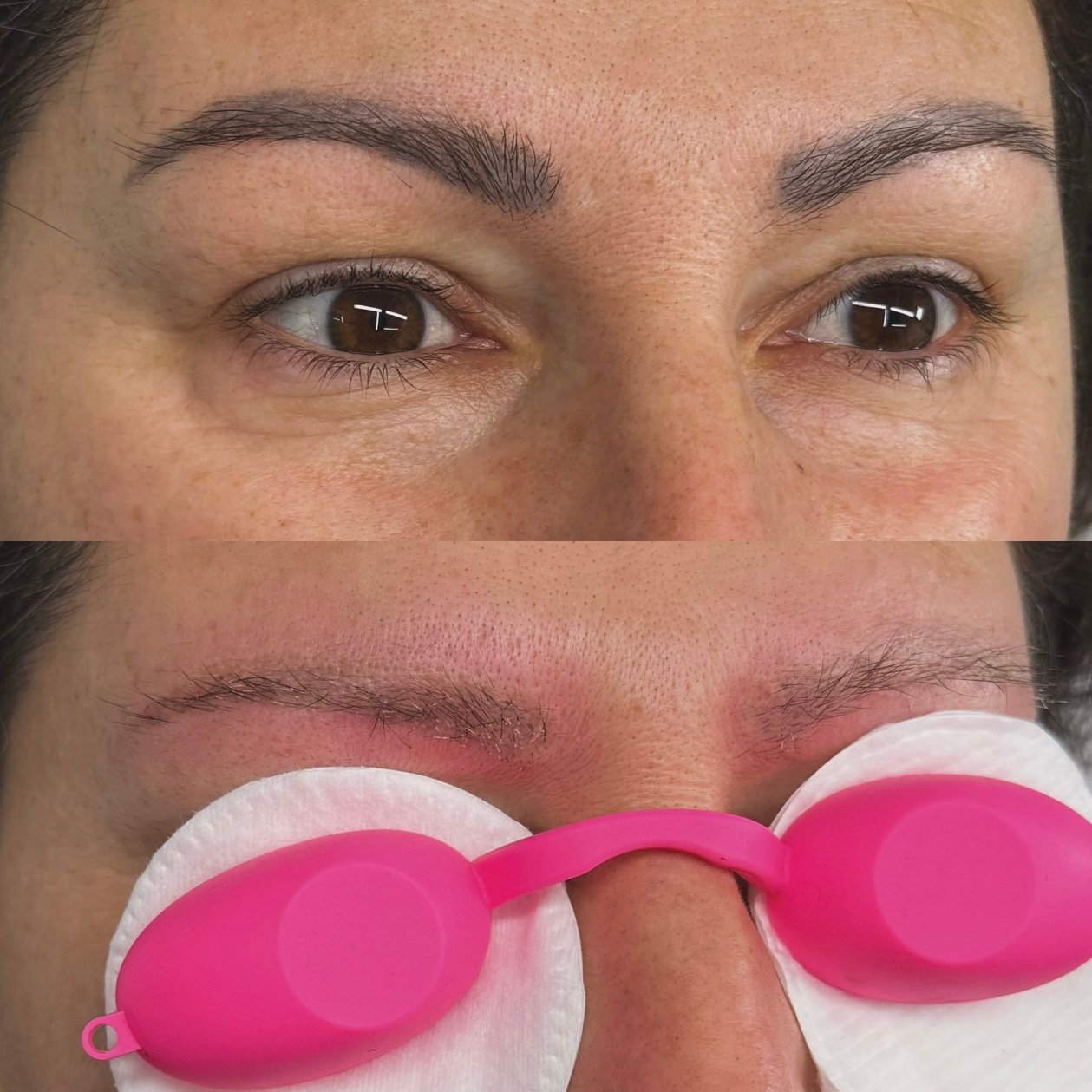 PMU brow tattoo removal before and after one session — Skarlet Leon Bournemouth