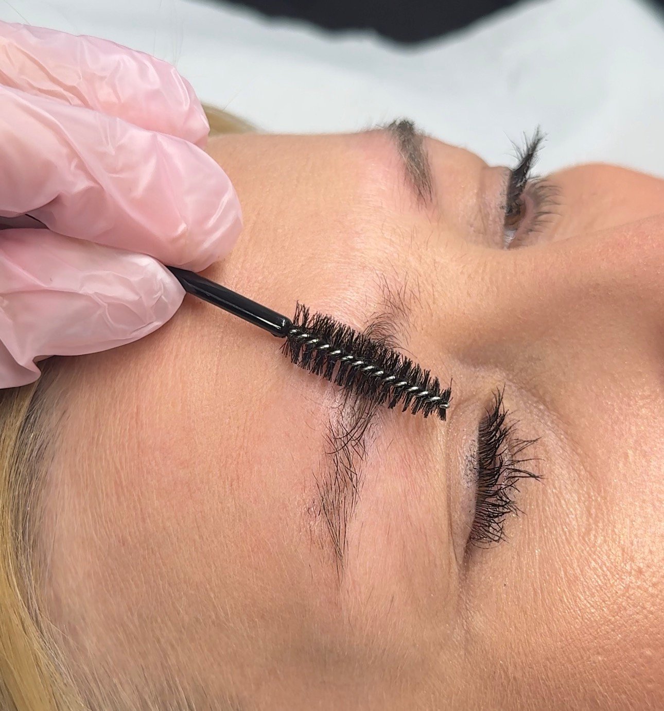 Brows healed 6 weeks after one removal session — Skarlet Leon Bournemouth