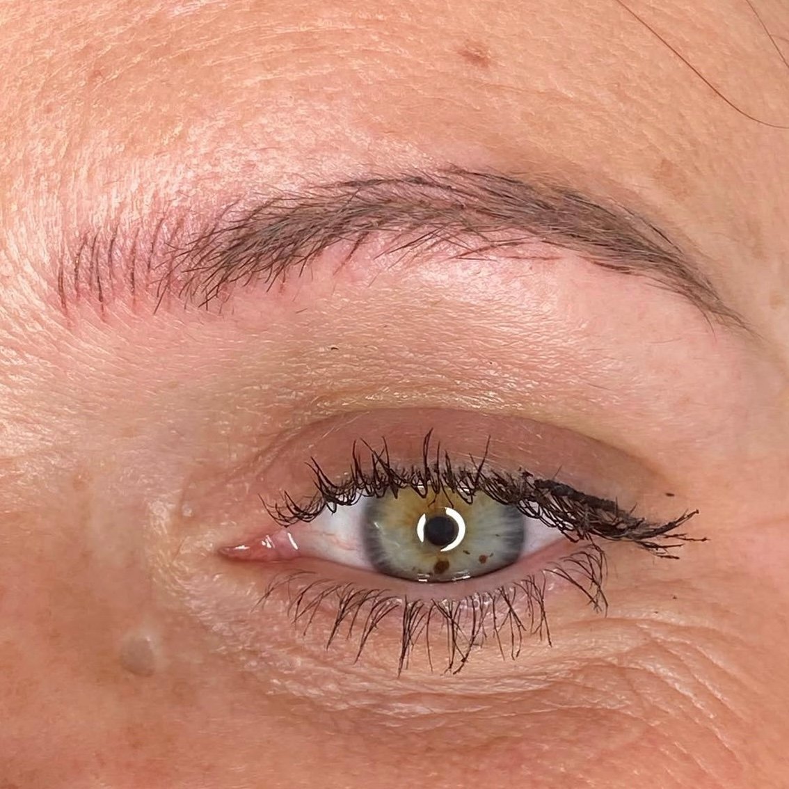 Brows before emergency saline removal — Skarlet Leon Bournemouth