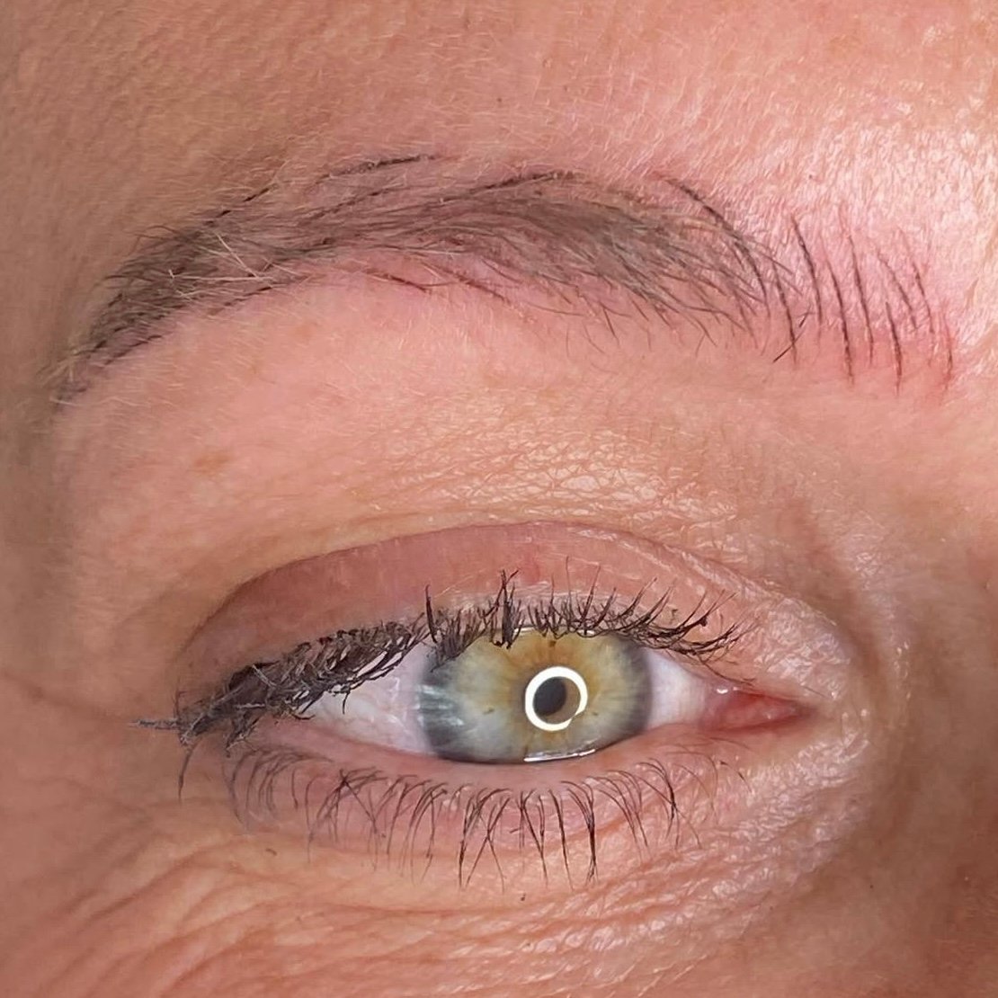 Brows before emergency removal close-up