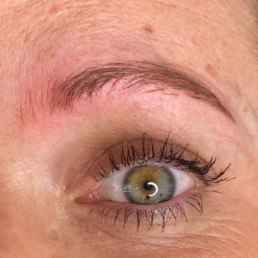 During emergency saline removal process — Skarlet Leon Bournemouth
