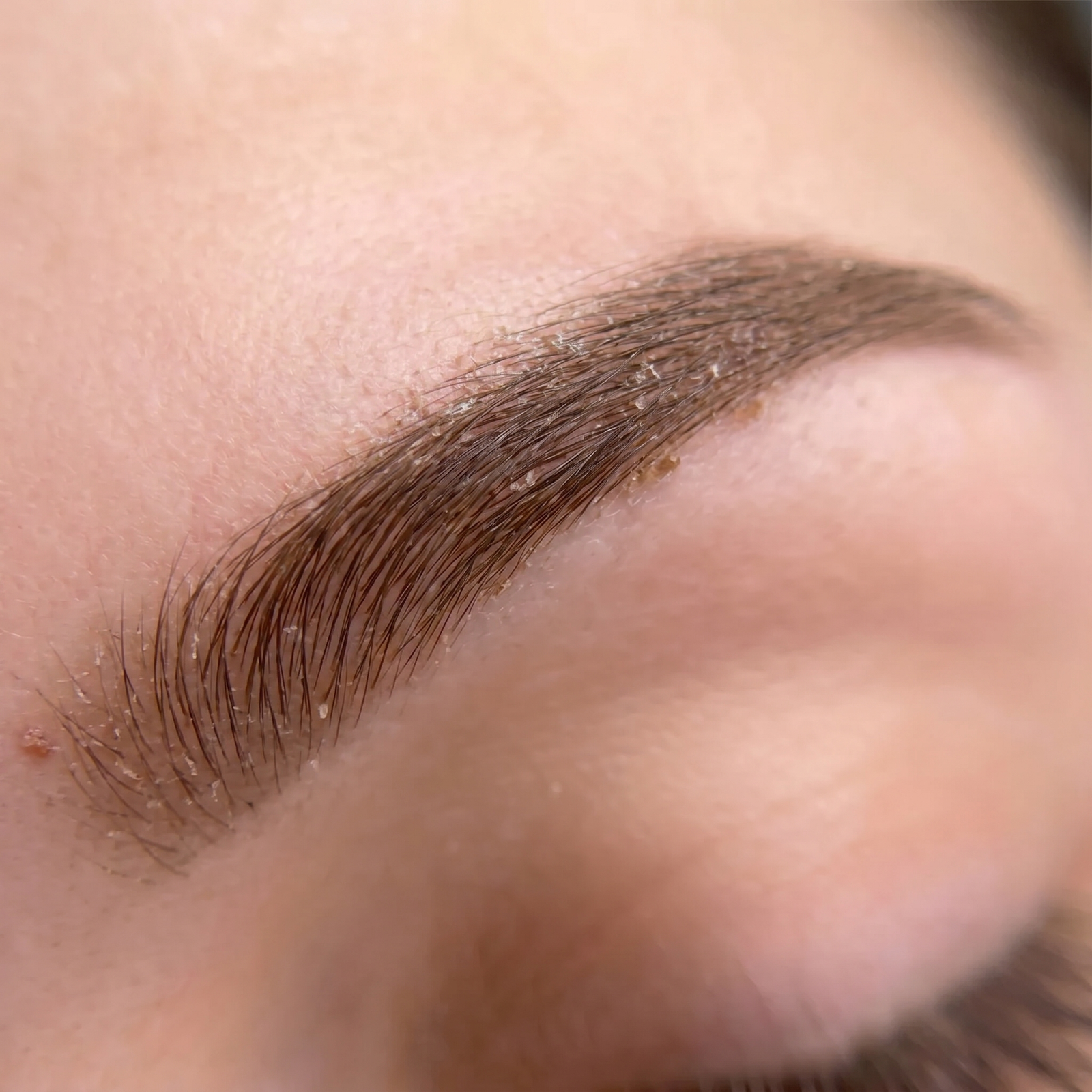 Brow flaking healing stage PMU