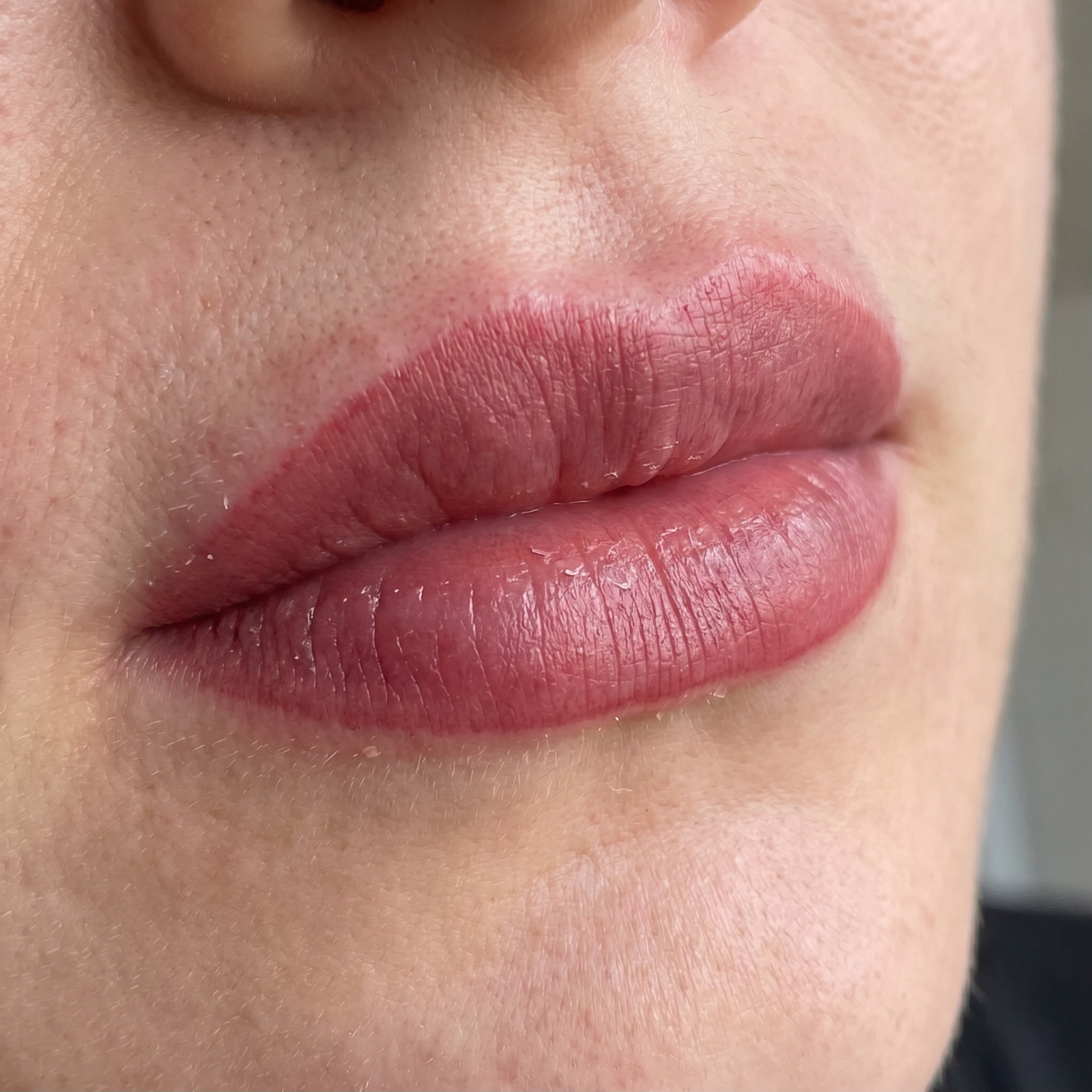 Tight dry lips healing stage