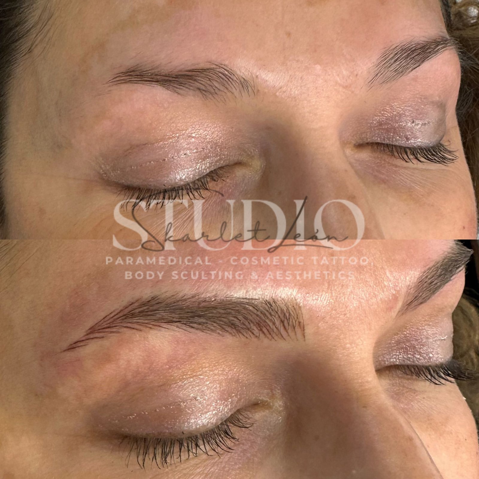 Nano brows — finer, more precise, skin compatible
