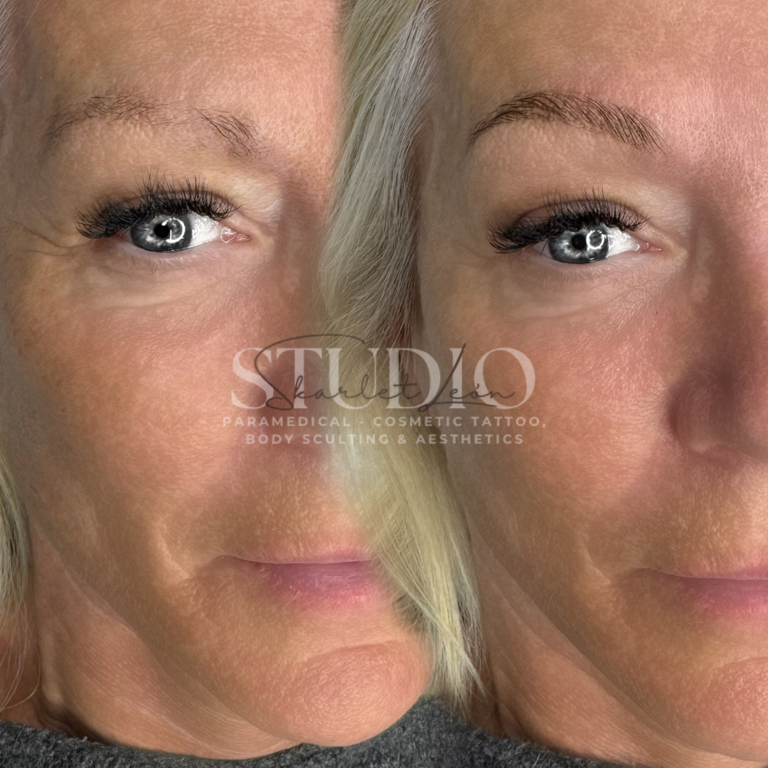 Mature client brow lamination before and after — Skarlet Leon Bournemouth